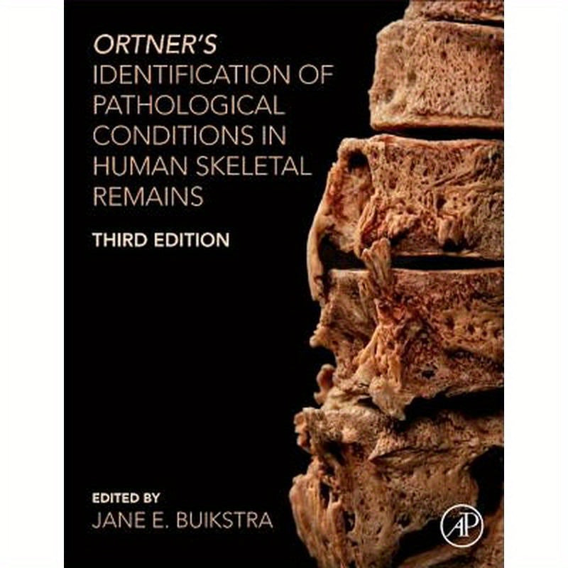Ortner's Identification of Pathological Conditions in Human Skeletal Remains
