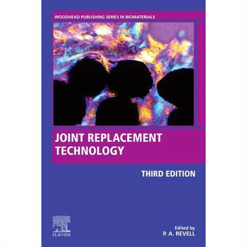 Joint Replacement Technology