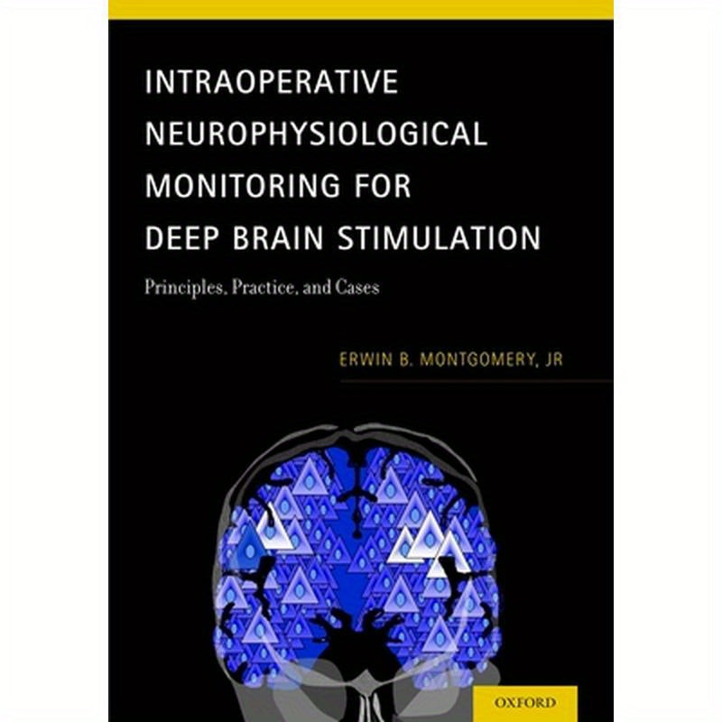 Intraoperative Neurophysiological Monitoring for Deep Brain Stimulation: Principles, Practice, and Cases