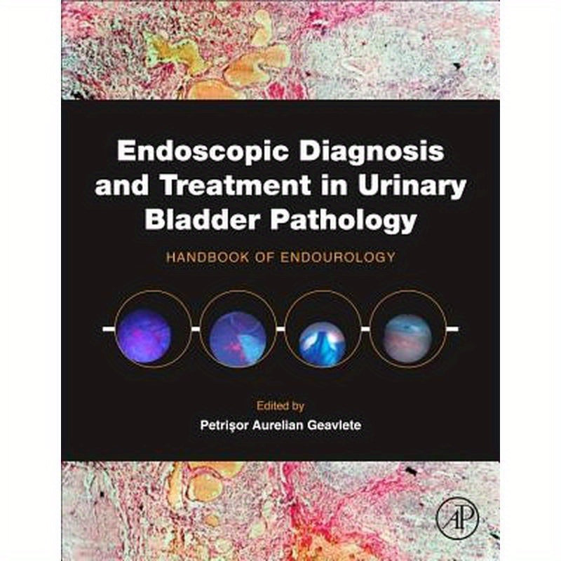 Endoscopic Diagnosis and Treatment in Urinary Bladder Pathology: Handbook of Endourology