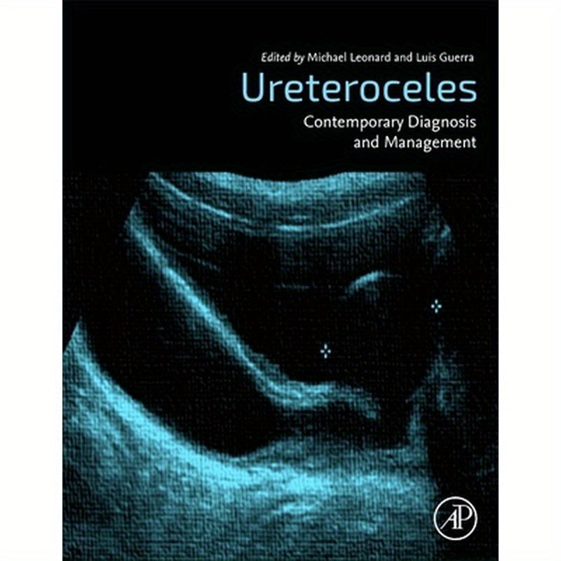 Ureteroceles: Contemporary Diagnosis and Management