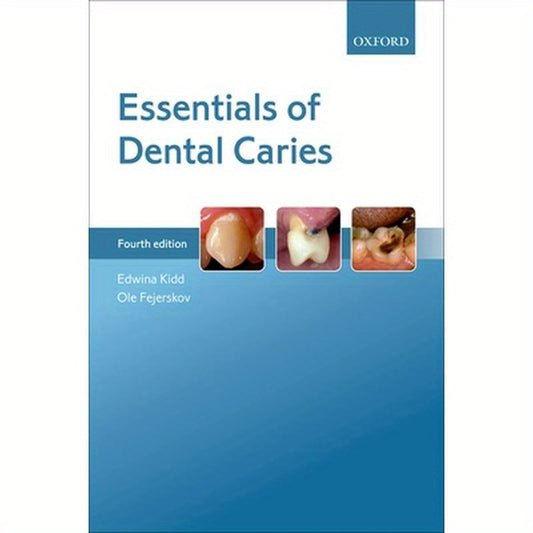 Essentials of Dental Caries 4e P