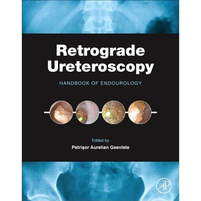 Retrograde Ureteroscopy: Handbook of Endourology
