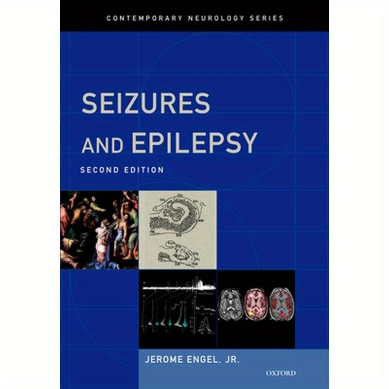 Seizures and Epilepsy