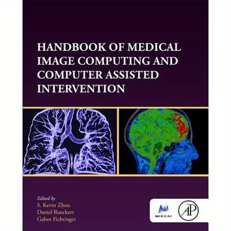 Handbook of Medical Image Computing and Computer Assisted Intervention