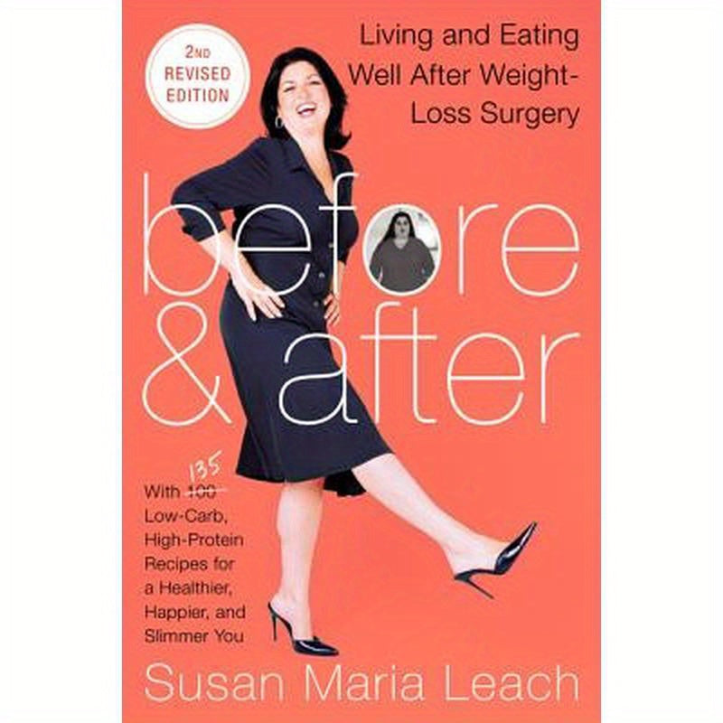 Before & After, Second Revised Edition: Living and Eating Well After Weight-Loss Surgery