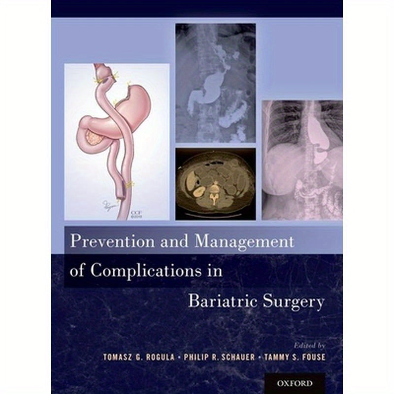 Prevention and Management of Complications in Bariatric Surgery