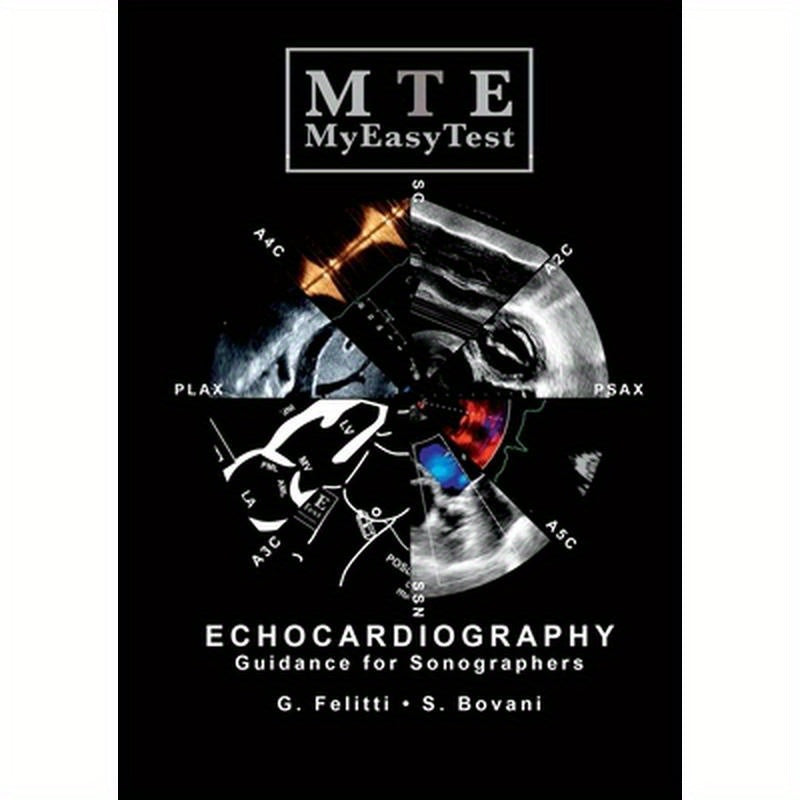 Echocardiography - MyEasyTest