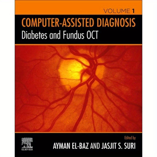 Diabetes and Fundus Oct