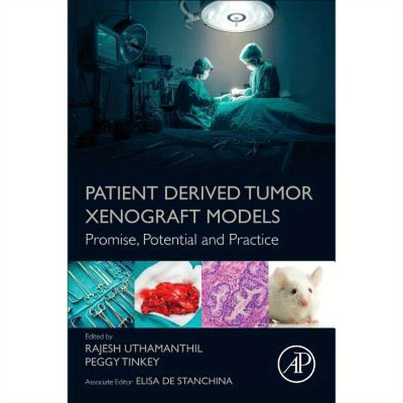 Patient Derived Tumor Xenograft Models: Promise, Potential and Practice
