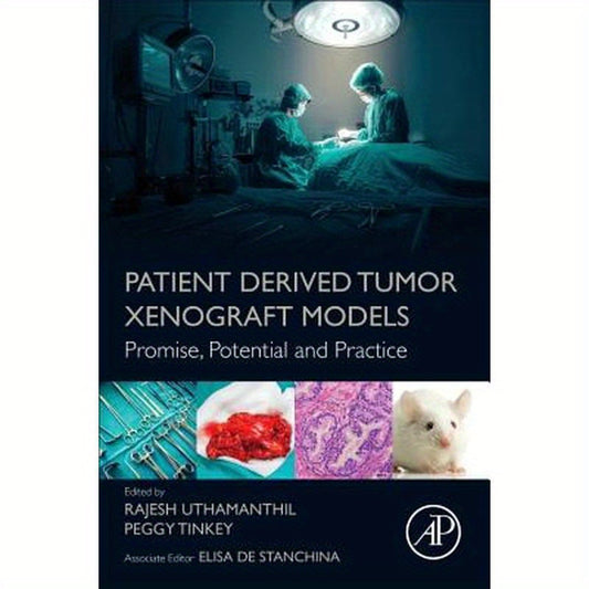 Patient Derived Tumor Xenograft Models: Promise, Potential and Practice