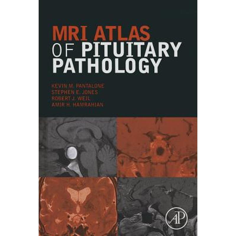 MRI Atlas of Pituitary Pathology
