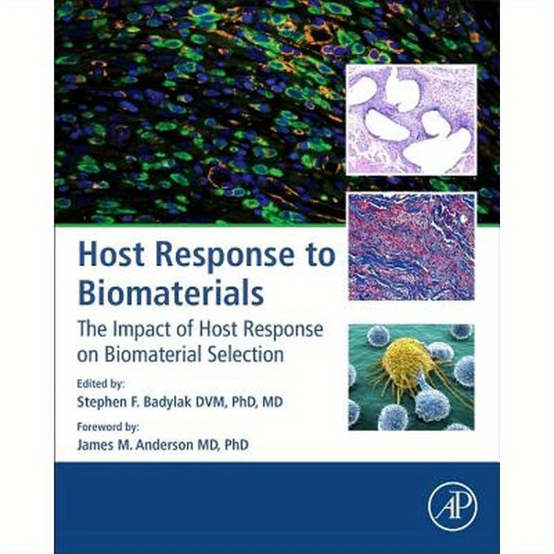 Host Response to Biomaterials: The Impact of Host Response on Biomaterial Selection