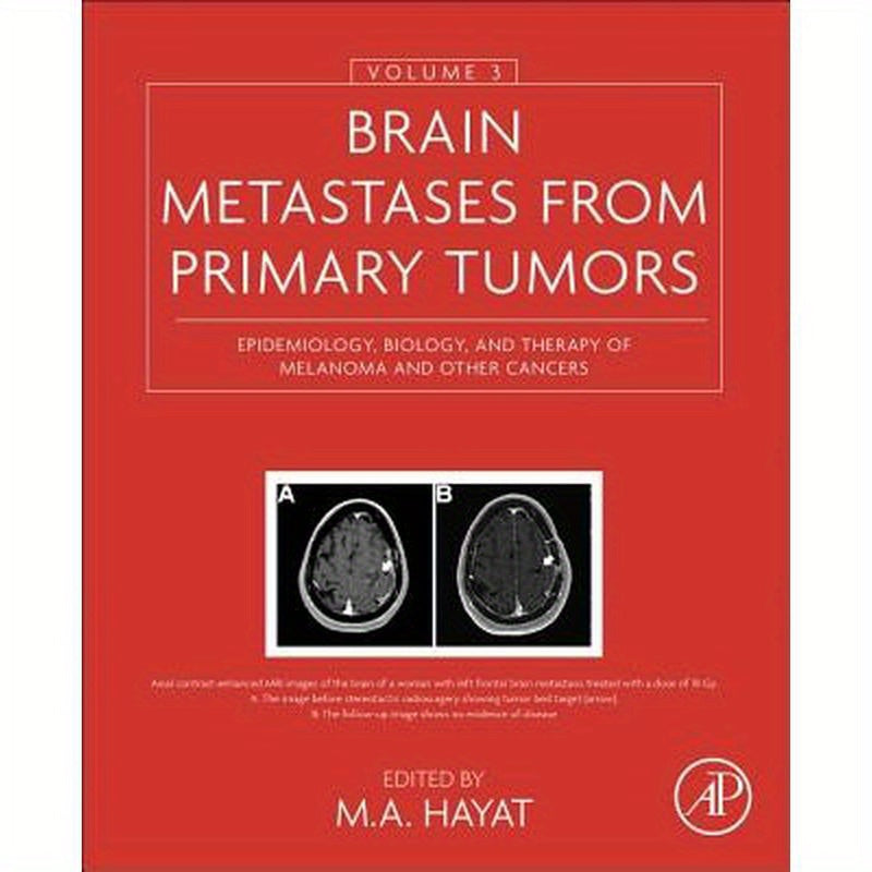 Brain Metastases from Primary Tumors, Volume 3: Epidemiology, Biology, and Therapy of Melanoma and Other Cancers